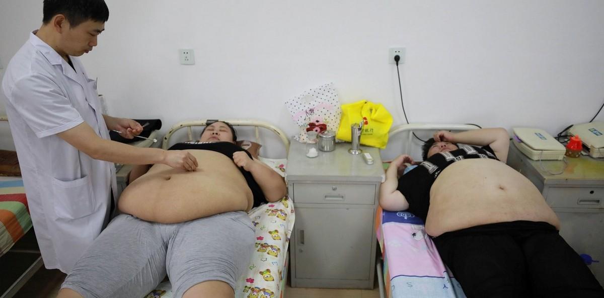 В Китае ожирение лечат банками