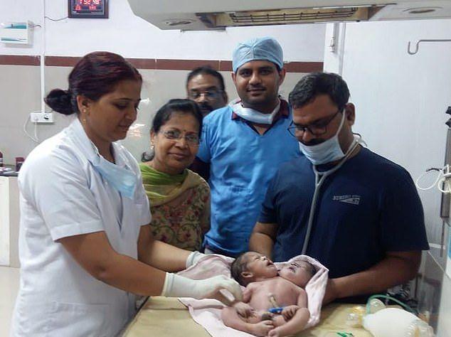 Индианка родила ребенка с 2 головами и 3 руками