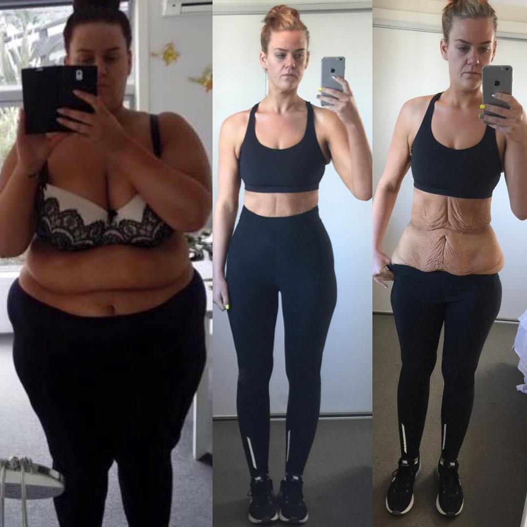 Новозеландка выложила процесс похудения на 100 килограммов в Instagram