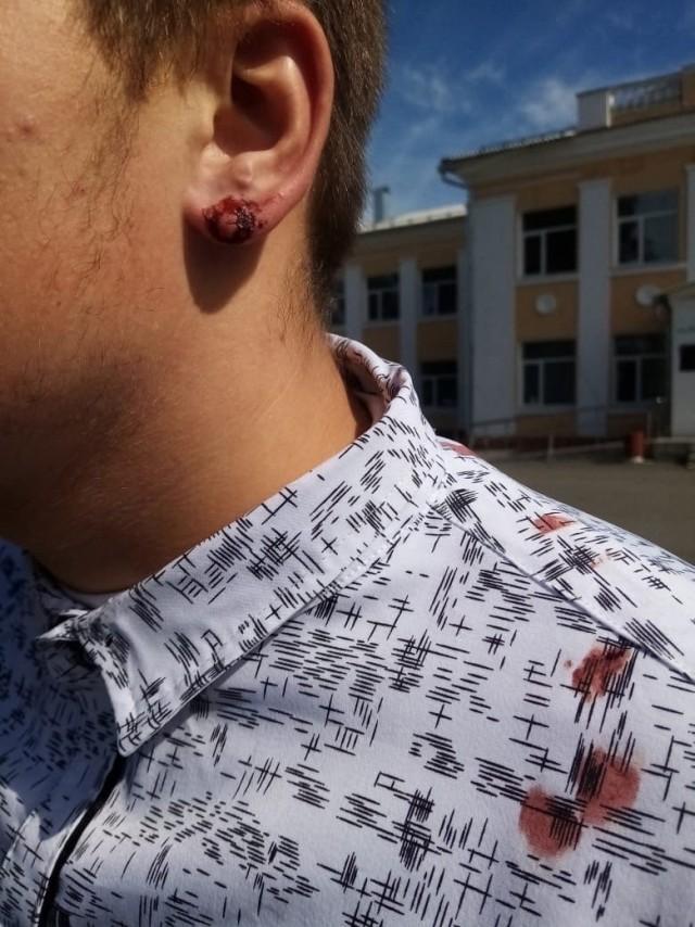  «Ходишь как пи**рас»: директор школы в Курской области порвал ухо восьмикласснику за то, что тот не хотел снимать серьгу
