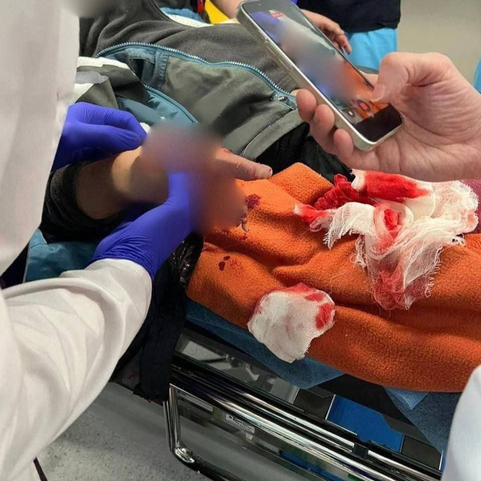 9-летний мальчик из Подмосковья поднял свёрток денег и потерял пальцы – подозрительный предмет взорвался прямо у него в руках