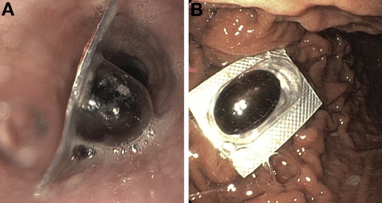 Что-то ваши таблетки мне не помогают