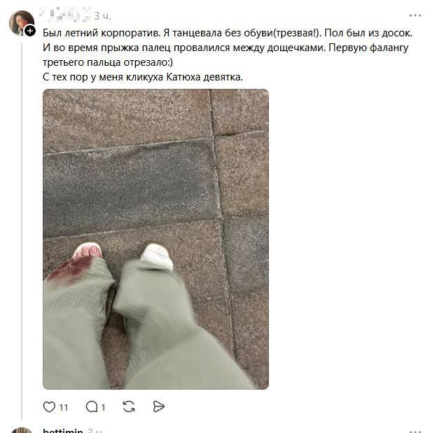Люди рассказывают про свои самые тупые травмы