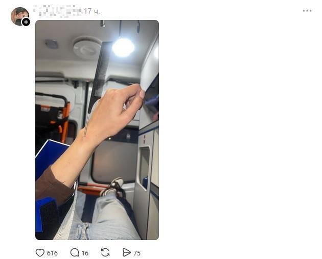 Люди рассказывают про свои самые тупые травмы