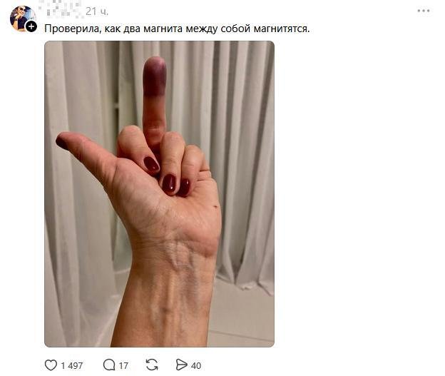 Люди рассказывают про свои самые тупые травмы