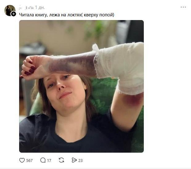Люди рассказывают про свои самые тупые травмы