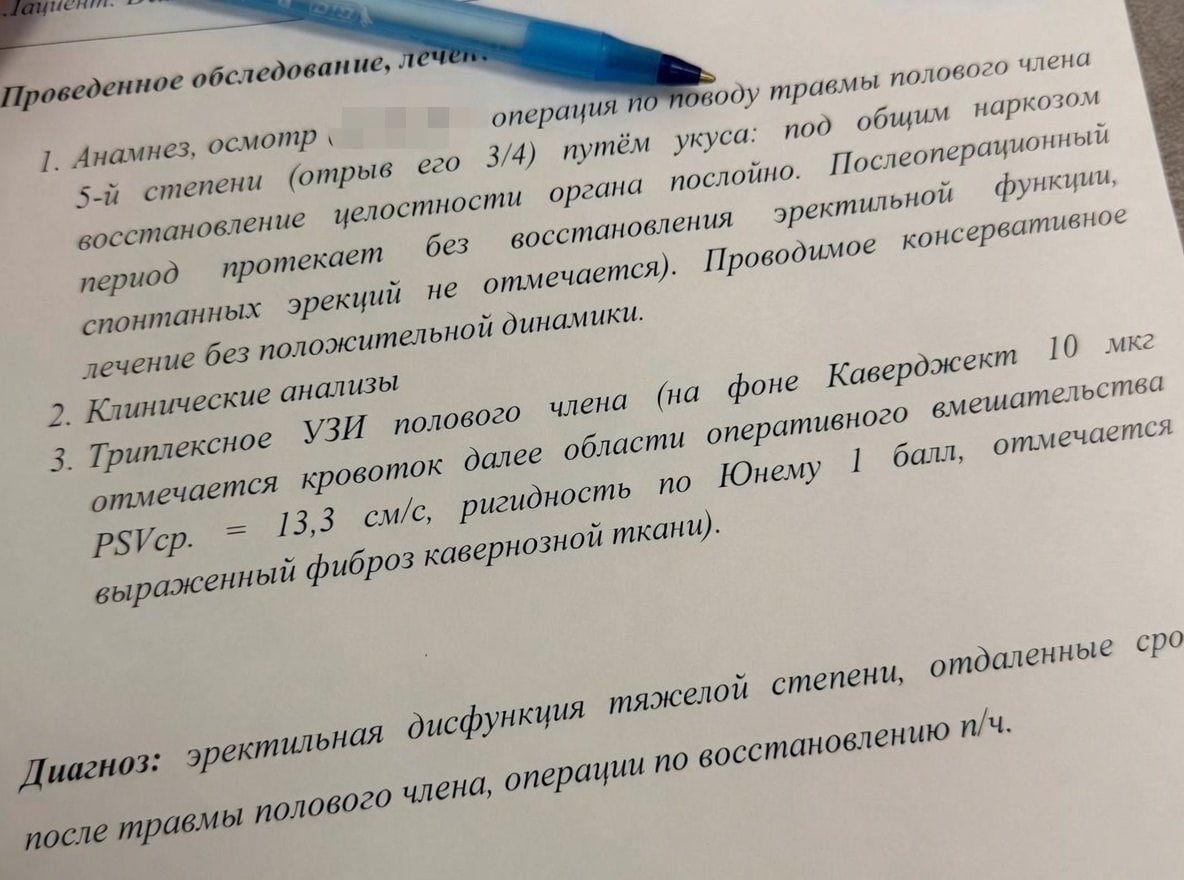Москвичка отгрызла член своему мужу, наточив зубы напильником — всё из-за ревности.