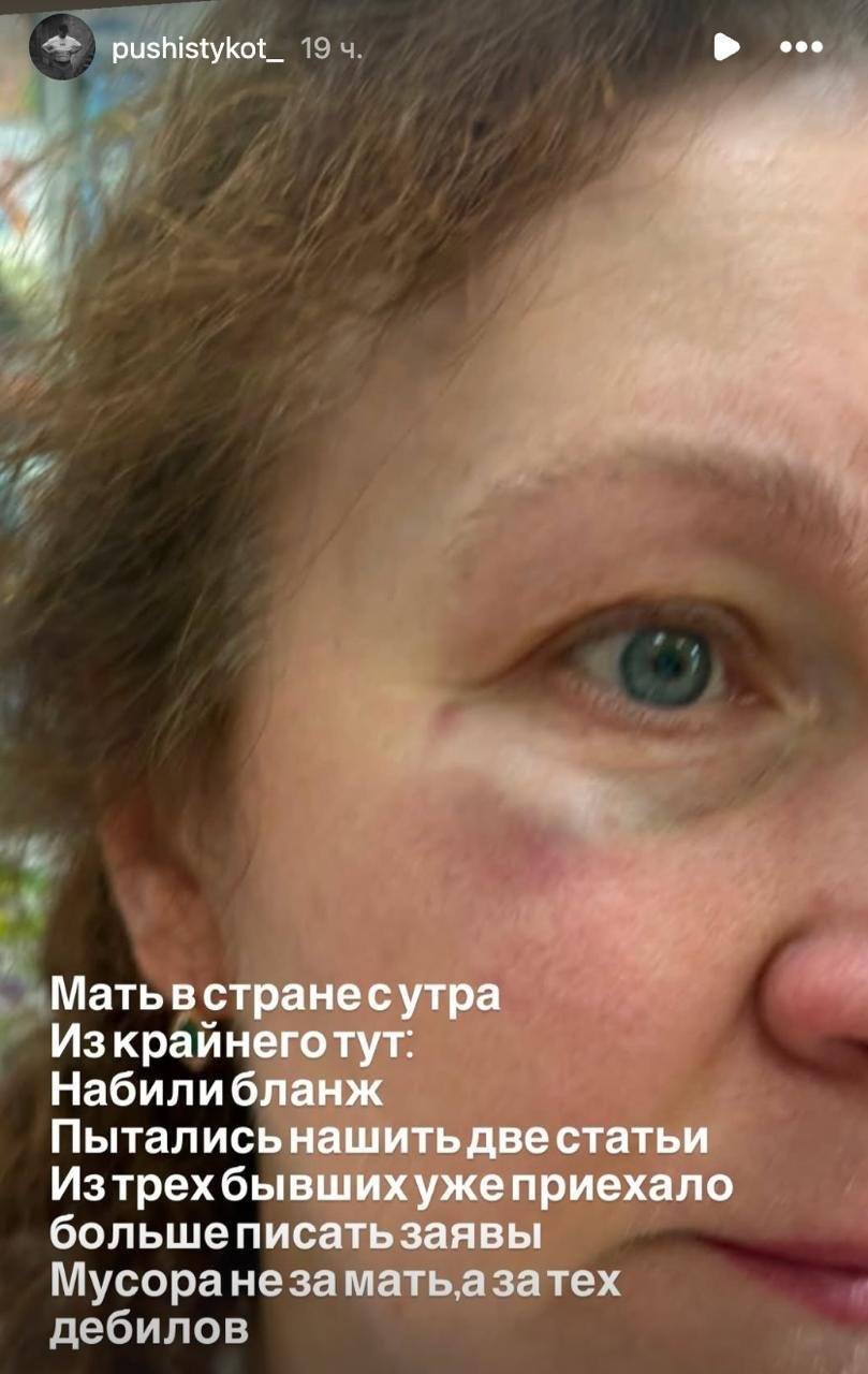 Мать украинского военного избили и высадили из львовского автобуса из-за русского языка